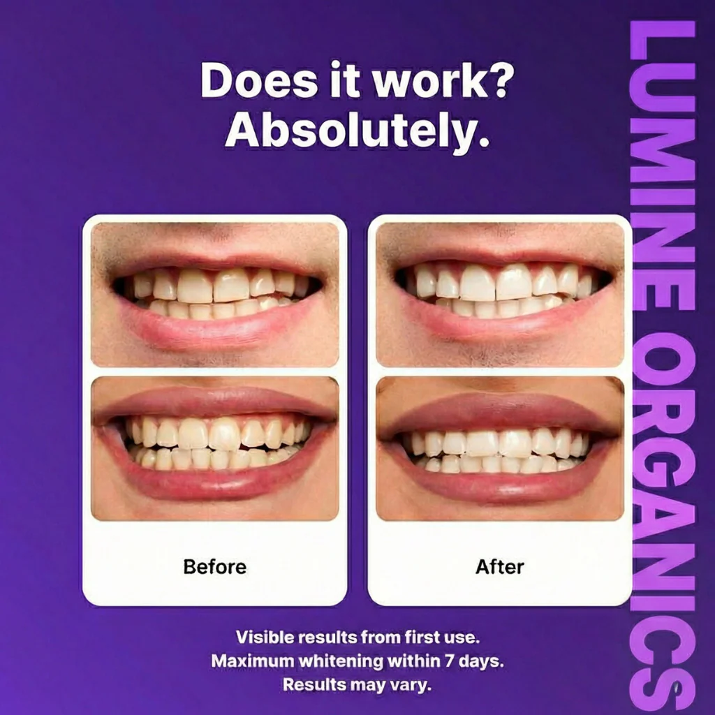 Purple Whitening Strips — Instant Brightening Strips - Image 4